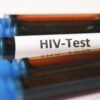 vials of blood and one of them labelled as hiv-test