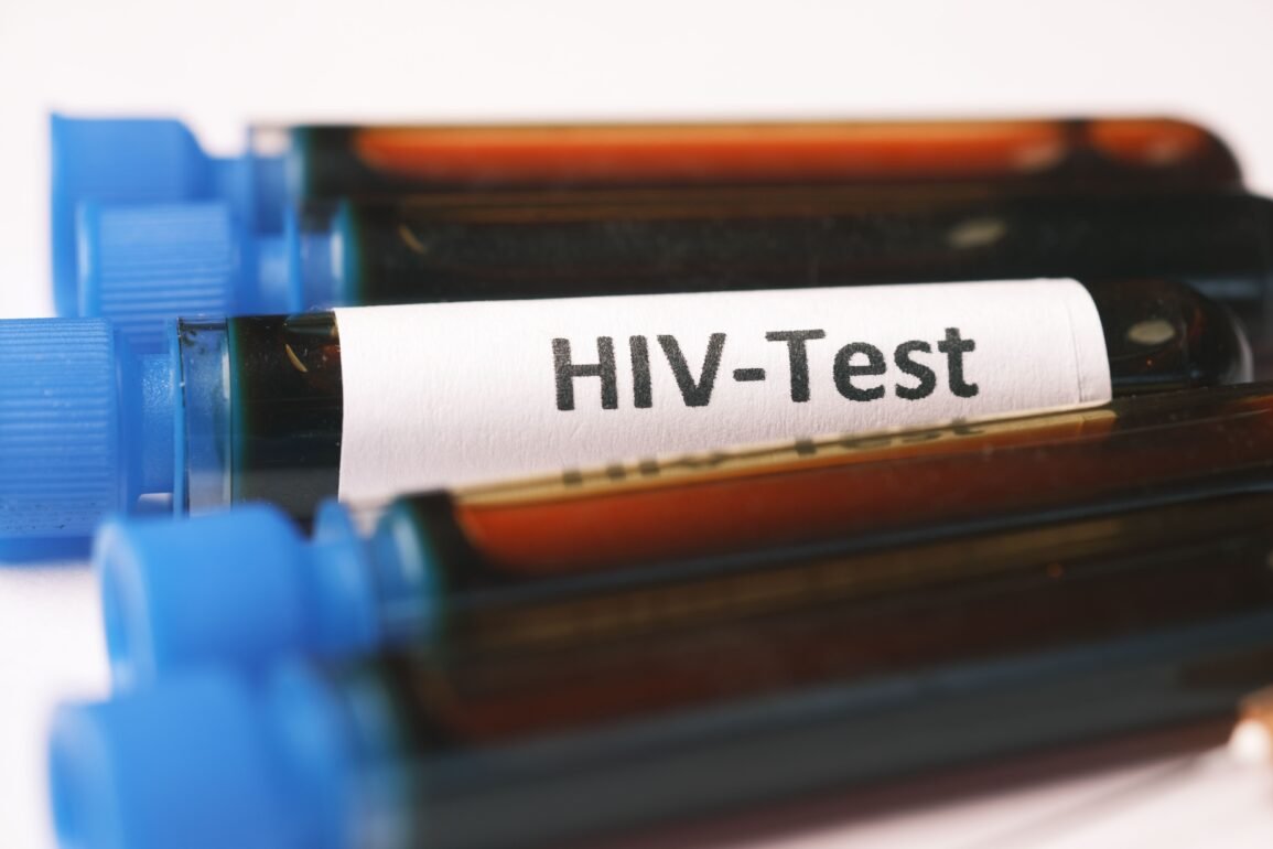 vials of blood and one of them labelled as hiv-test