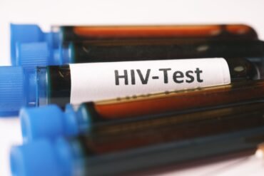 vials of blood and one of them labelled as hiv-test