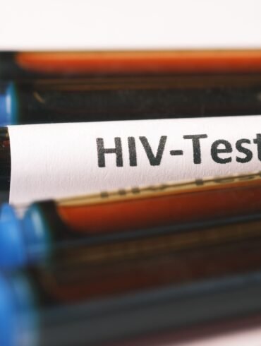 vials of blood and one of them labelled as hiv-test
