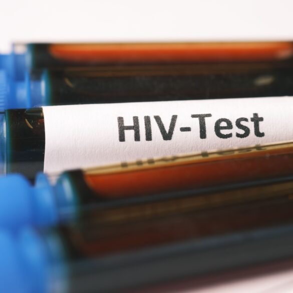 vials of blood and one of them labelled as hiv-test