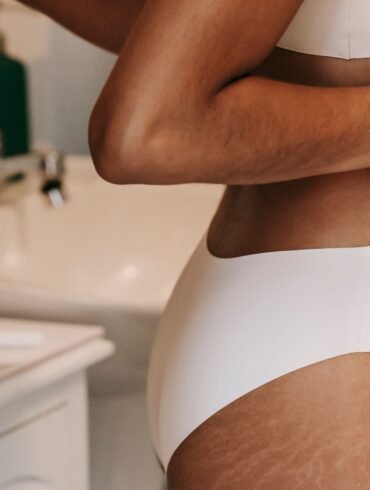 a woman in her underwear showing off her stretch marks