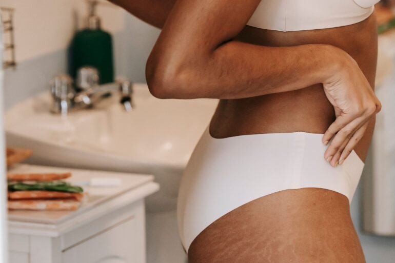 a woman in her underwear showing off her stretch marks